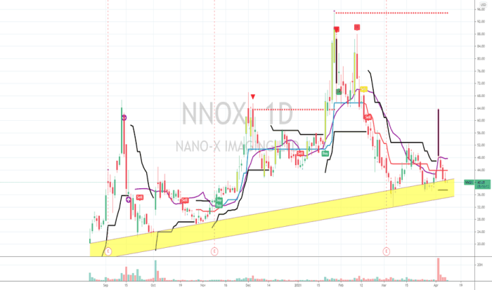 Nnox stock price